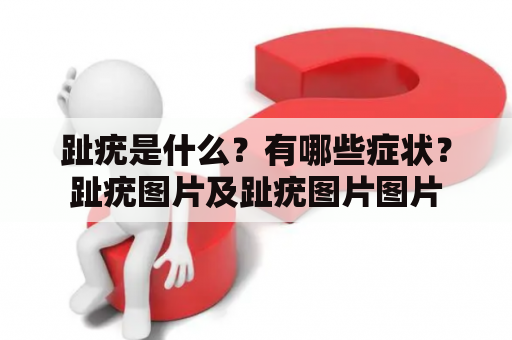 趾疣是什么？有哪些症状？趾疣图片及趾疣图片图片